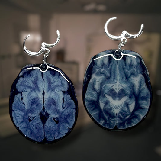 Brain scan earrings, one with a tumor and one healthy, on a blurred background.