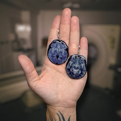 Hand holding brain scan earrings, one with a tumor and one healthy, on a blurred background.